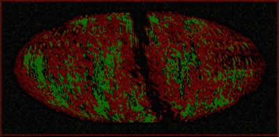 logo Estenosis Aortica